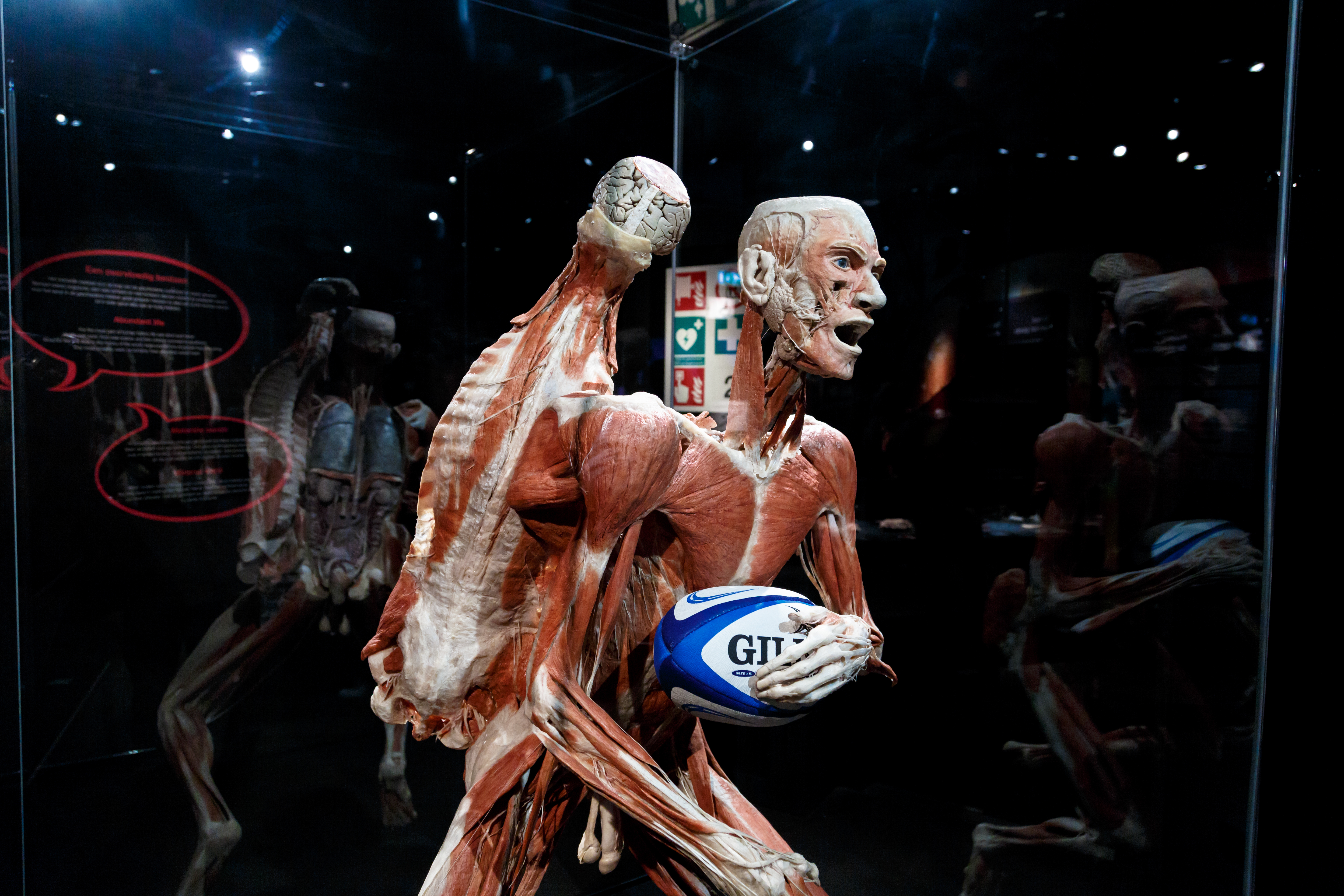 荷兰阿姆斯特丹 人体世界博物馆 body worlds: the happiness project